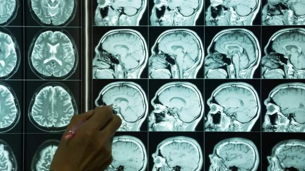 UCSD lidera estudio sobre envejecimiento cerebral en latinos con financiamiento millonario en San Diego