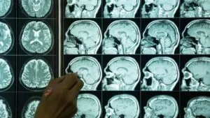 UCSD lidera estudio sobre envejecimiento cerebral en latinos con financiamiento millonario en San Diego