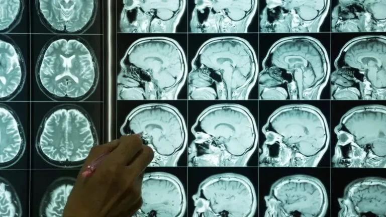 UCSD lidera estudio sobre envejecimiento cerebral en latinos con financiamiento millonario en San Diego