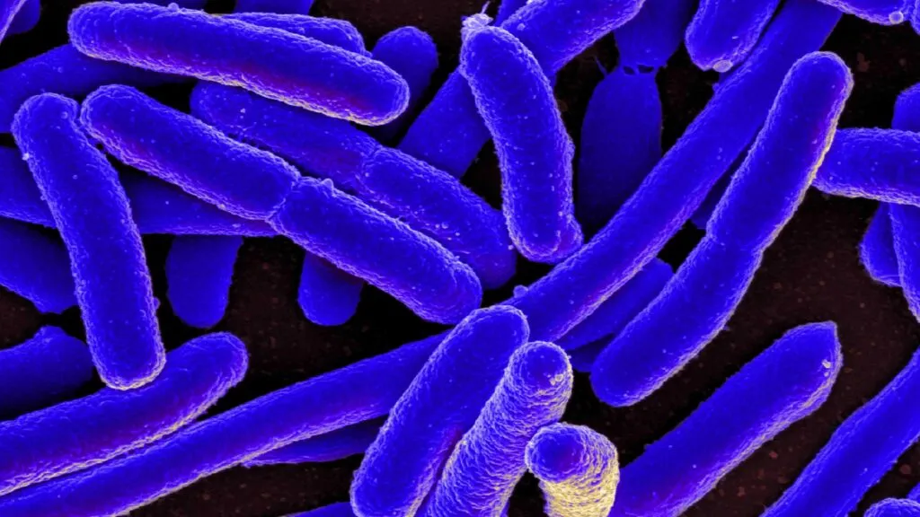 Brote de E. coli en California fue vinculado con productos vendidos por The Kebab Shop